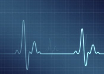EKG