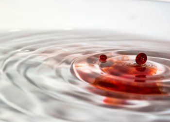 3 problems with Ripple